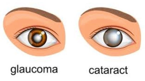 What Is The Difference Between Cataracts And Glaucoma Vision Source Rio