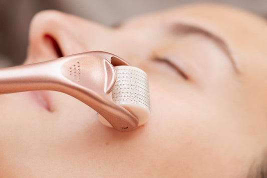 Microneedling Aftercare: A Complete Guide for Beautiful Skin