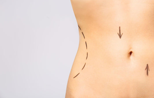 How Long Does Body Contouring Last? [Answered] - Vision Source Rio